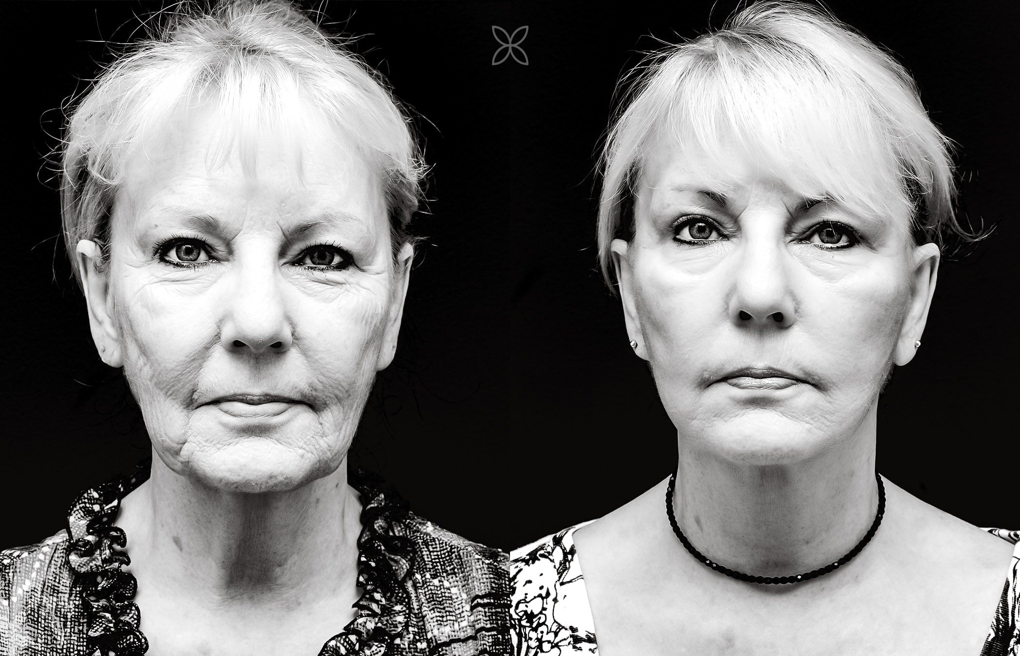 Stunning facial transformation before and after